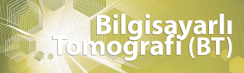 Bilgisayarlı Tomografi (BT)